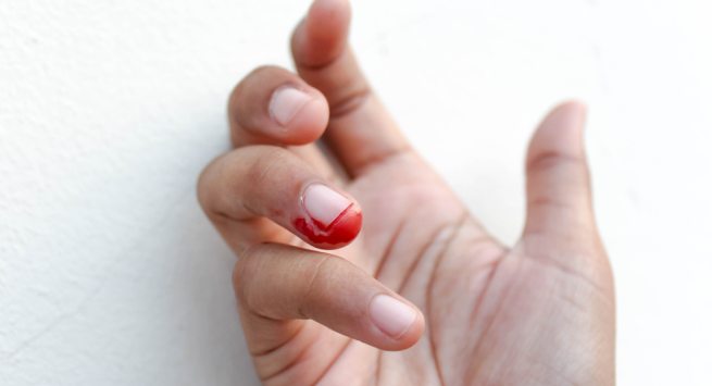 Cắn móng tay có thể dẫn đến tử vong vì bị nhiễm trùng huyết