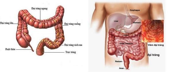 gioi-thieu-mot-so-bai-thuoc-hay-chua-benh-viem-dai-trang