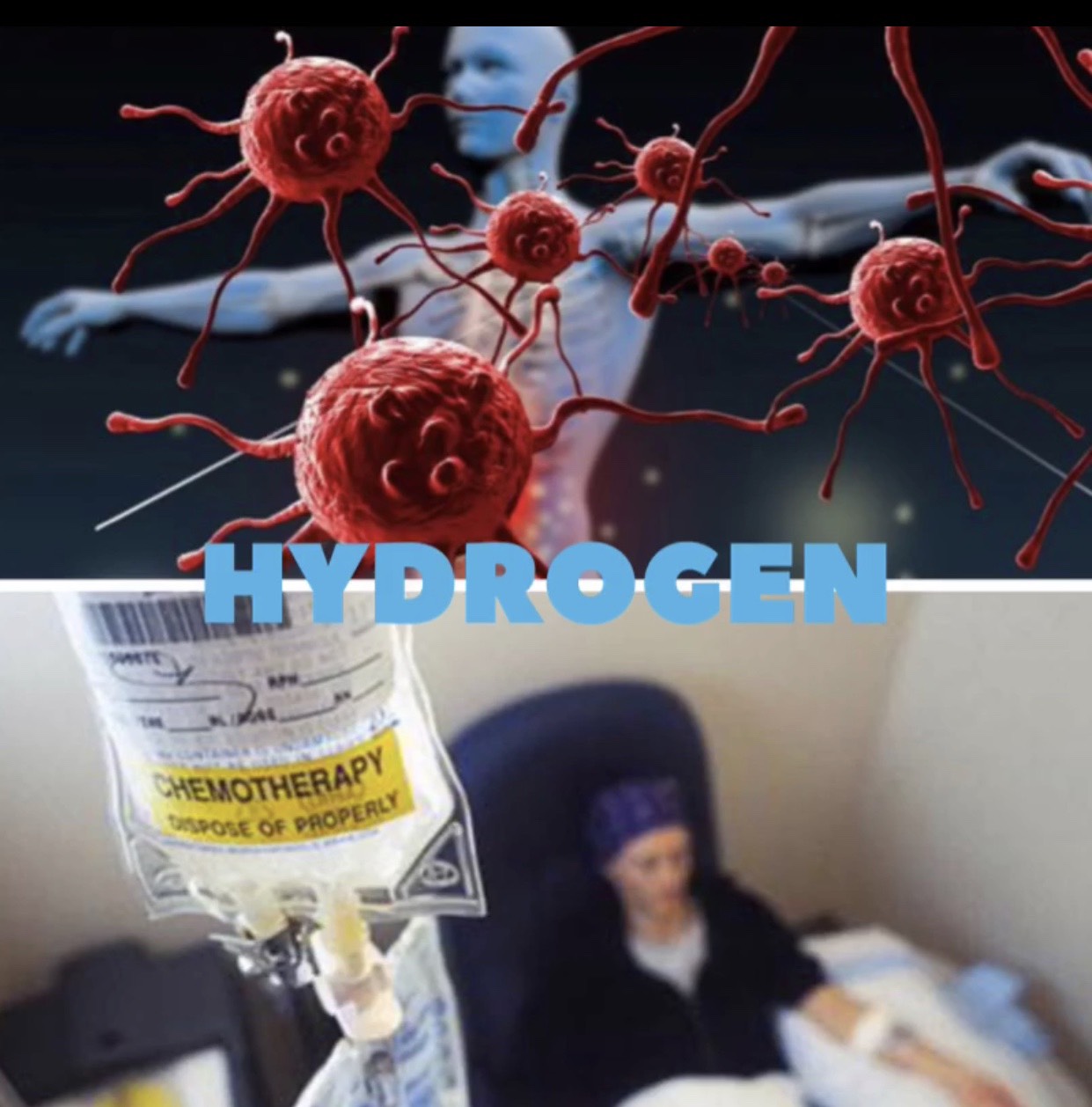 hydrogen-trong-dieu-tri-ung-thu
