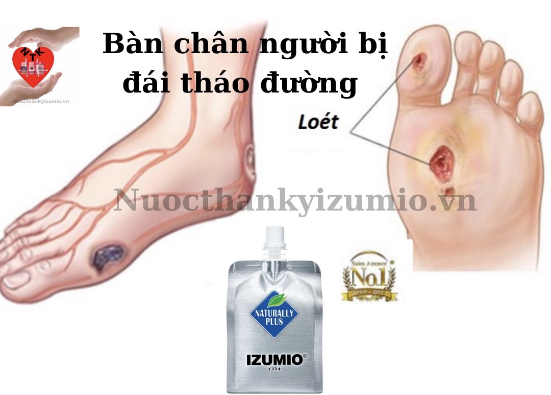 nuoc-than-ky-izumio-mang-lai-hieu-qua-cao-cho-vet-thuong-ho-va-viem-nhiem