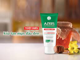 Sữa rửa mặt Acness ngăn ngừa mụn đầu đen 100g