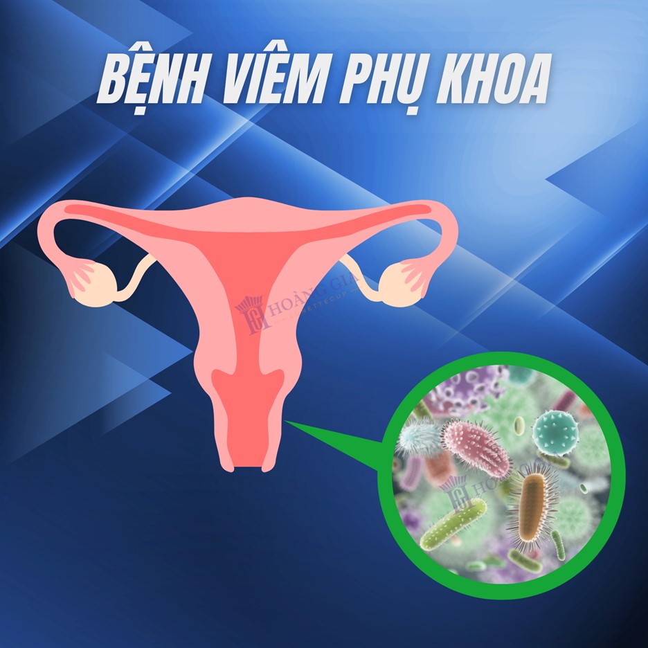 TOP 7 Dấu hiệu viêm phụ khoa phổ biến ở Phụ nữ