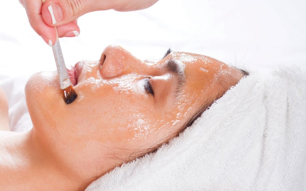 chemical-peel