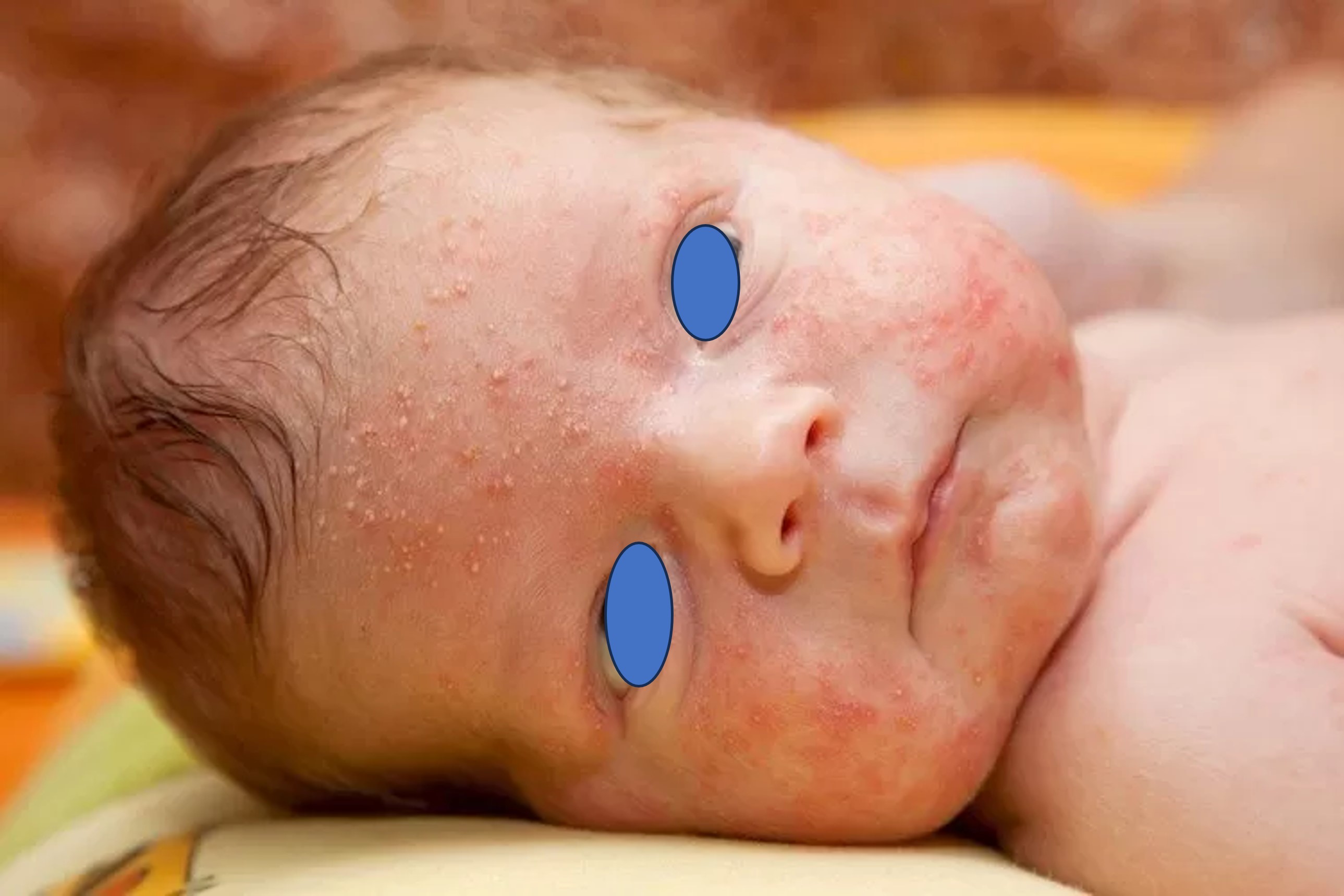 ban-can-lam-gi-neu-nghi-con-minh-di-ung-dam-sua-bo