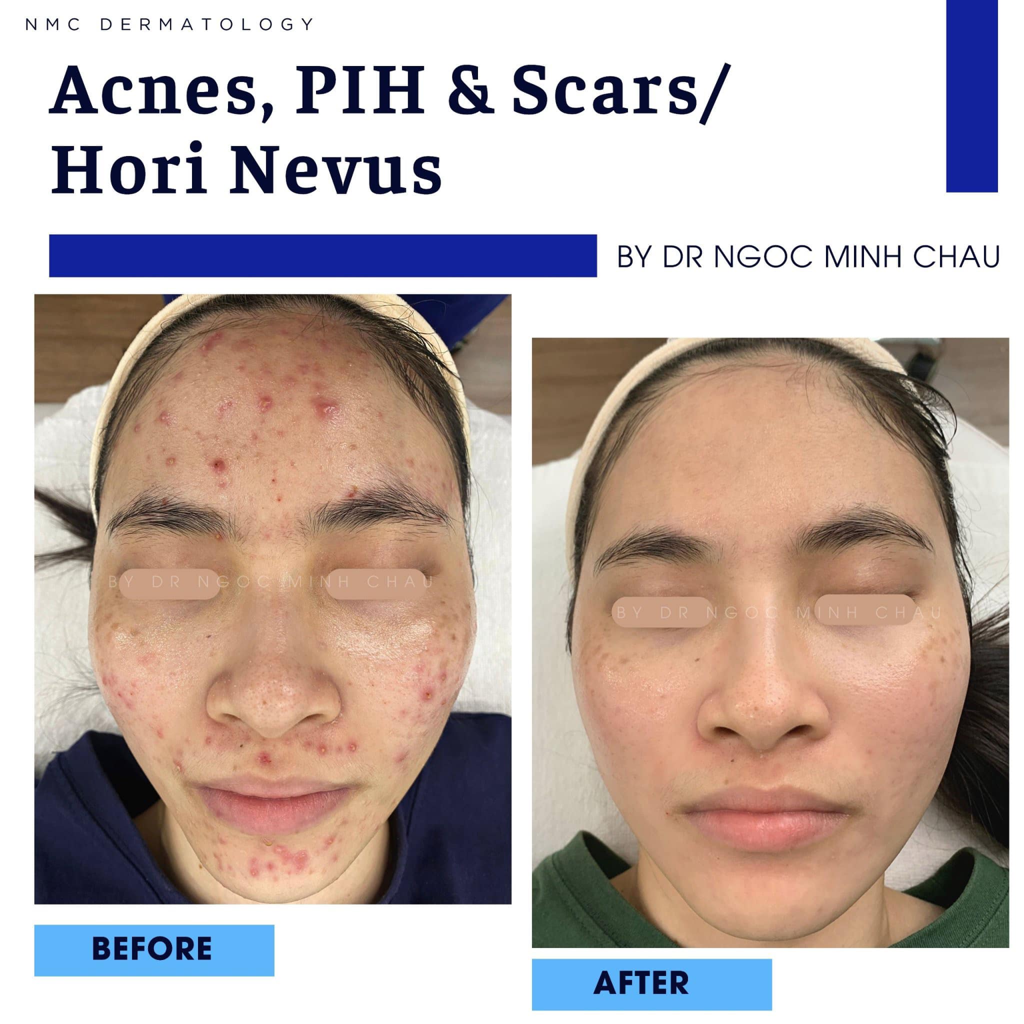 DA LIỄU THẨM MỸ