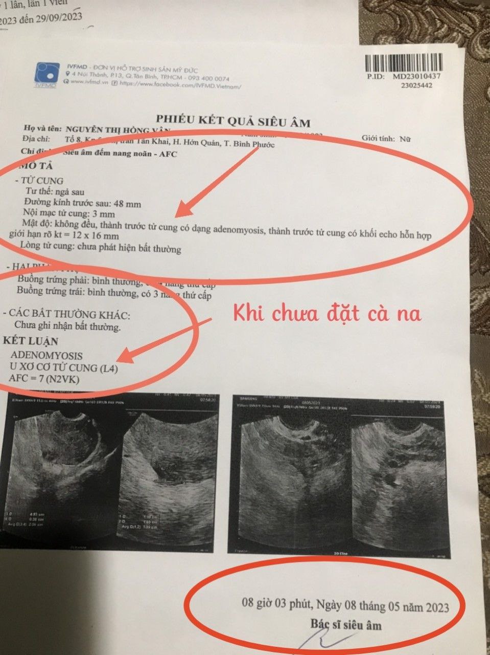 Cà na muối kiềm thực dưỡng