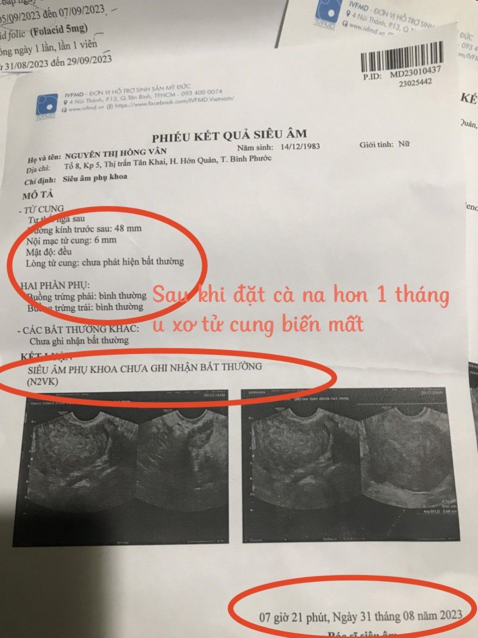 Cà na muối kiềm thực dưỡng