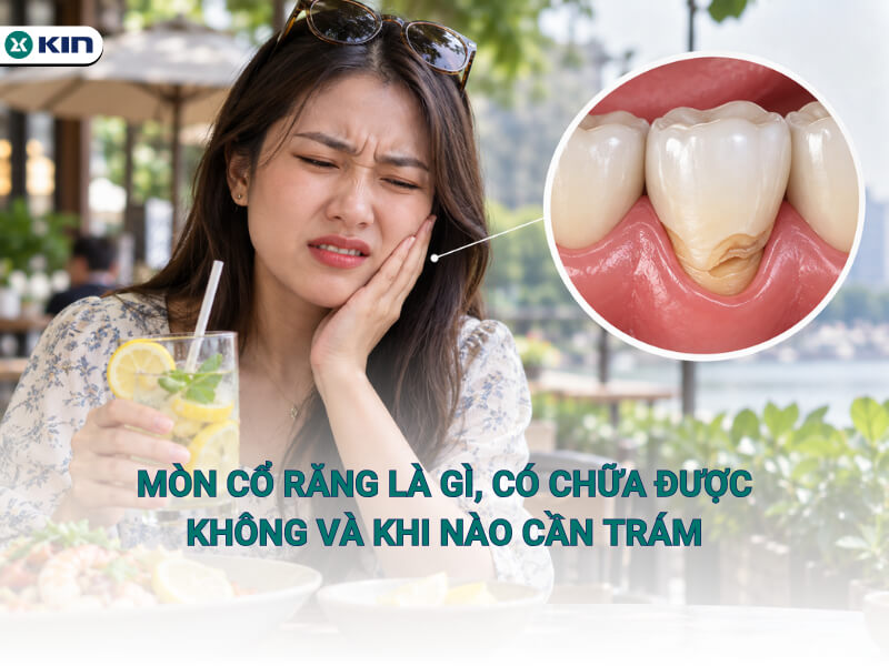 Mòn cổ răng là gì, có chữa được không và khi nào cần trám