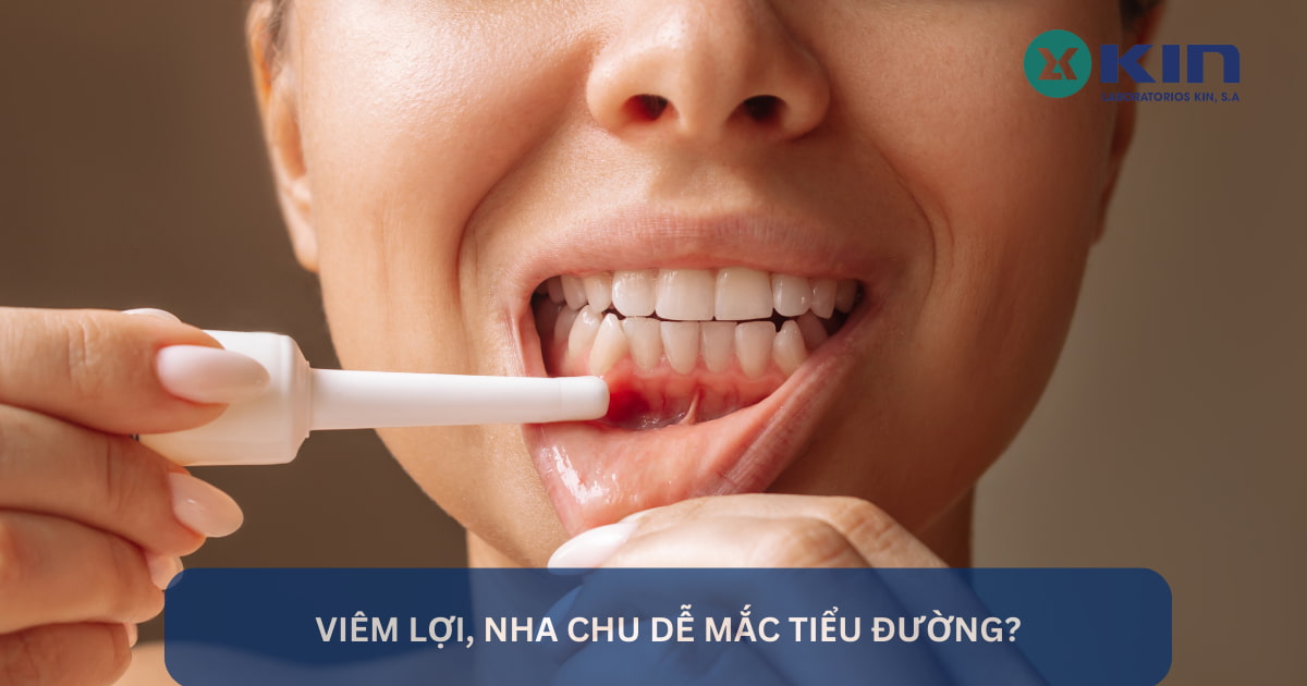 VIÊM LỢI, NHA CHU DỄ MẮC TIỂU ĐƯỜNG?