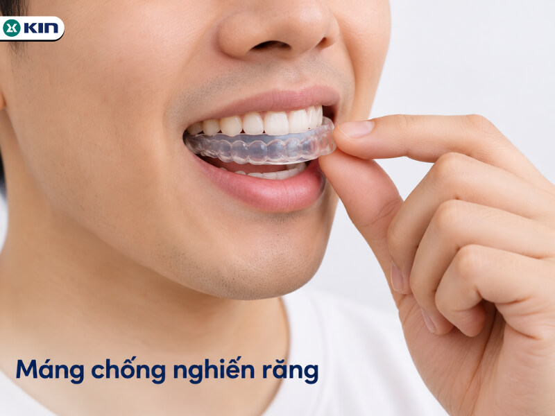 Máng chống nghiến răng