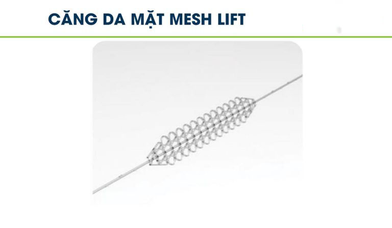 Căng Da Mặt Mesh Lift tại Spala