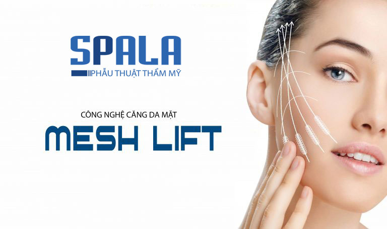 Căng Da Mặt Mesh Lift tại Spala