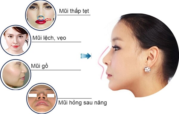 sua-mui-tai-spala.jpg