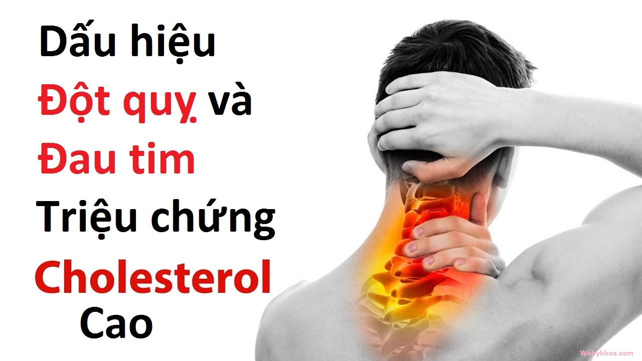 Phương pháp ngăn ngừa đột quỵ hiệu quả