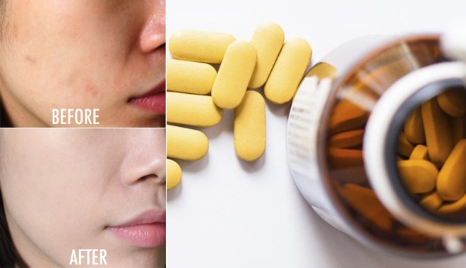 Nghiền nát 10 viên vitamin B1 trộn với sữa chua để tắm, da đen xì cũng trắng bóc sau 15 phút Nghiền nát 10 viên vitamin B1 trộn với sữa chua để tắm, da đen xì cũng trắng bóc sau 15 phút