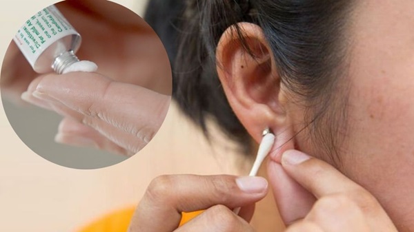 Cách xử lý khi tai bị viêm nhiễm do đeo bông tai