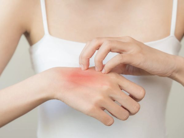 Tác động bởi bụi bẩn hoặc mỹ phẩm gây ngứa da khi đeo trang sức bạc