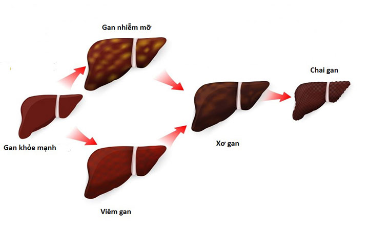 Các bệnh lý về gan