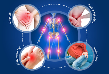 Các bệnh cơ xương khớp hay mắc phải ở người già