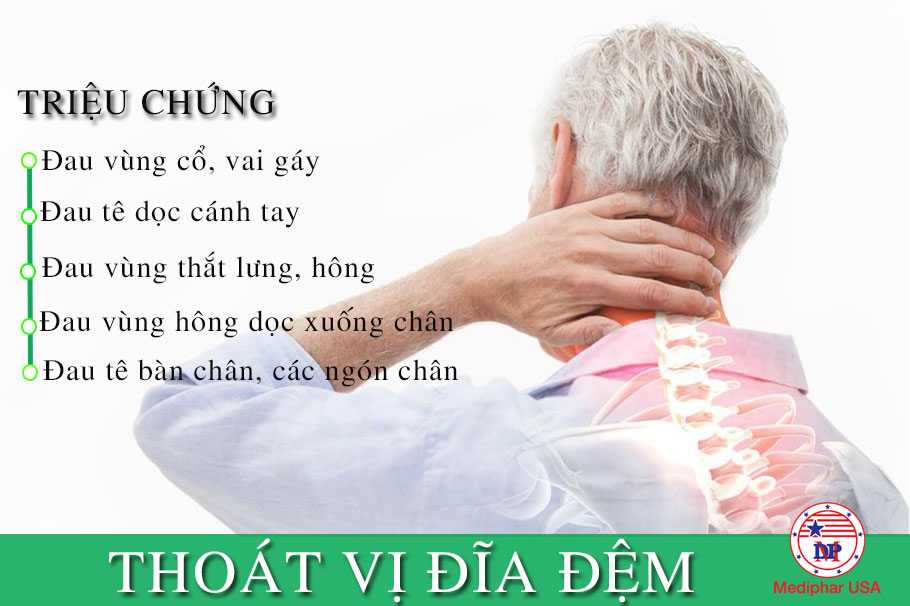 GLUCOSAMINE 1500 - THỰC PHẨM CHỮA XƯƠNG KHỚP TỐT QUẢNG NINH