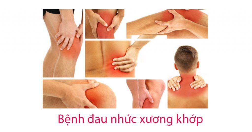 AI ĐANG BỊ ĐAU NHỨC XƯƠNG KHỚP MÀ KHÔNG BIẾT ĐẾN THẦN DƯỢC  NÀY THÌ QUÁ ĐÁNG TIẾC !!!