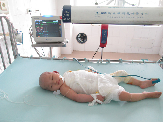 SLS Là Gì ? Vấn Đề Ảnh Hưởng Nghiêm Trọng Lên Da Bé