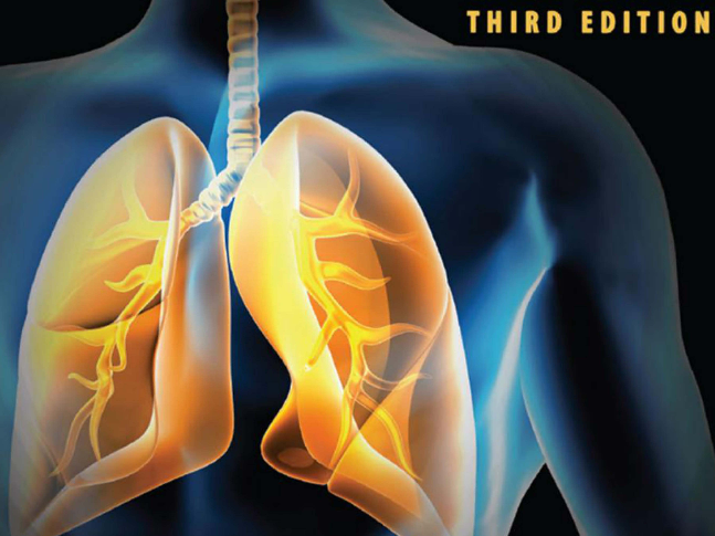 Essentials of Mechanical Ventilation