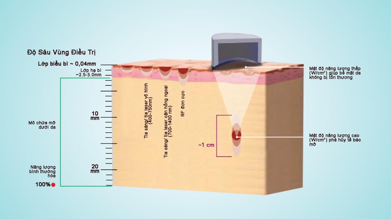Công Nghệ Giảm Béo Hifu Lipo