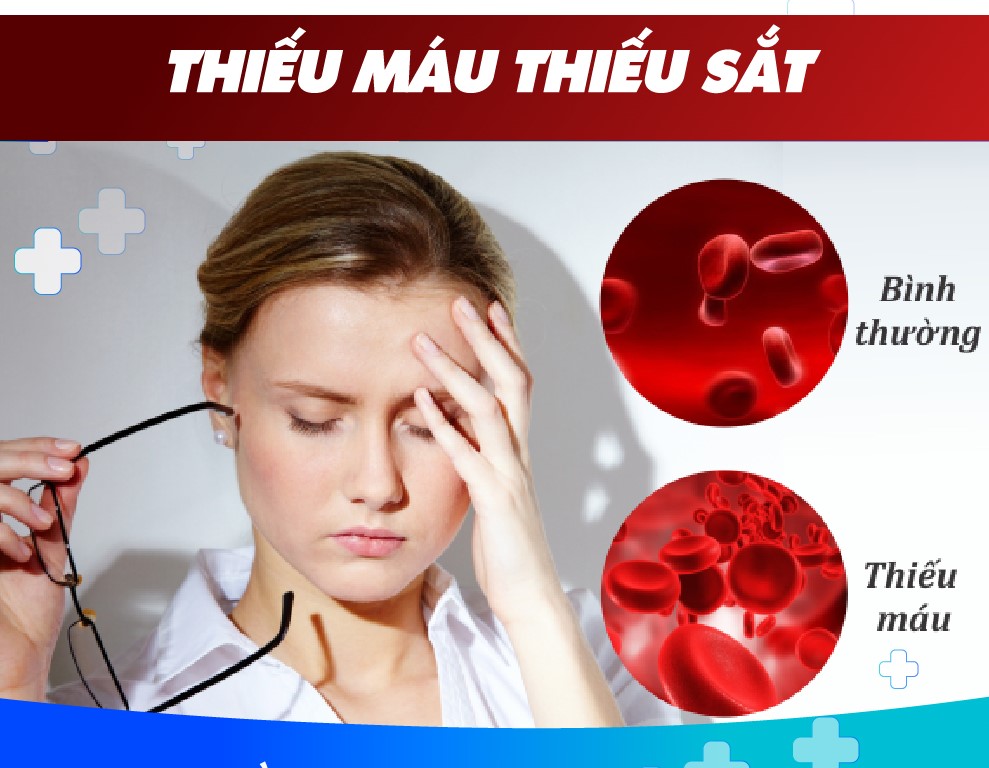 DẤU HIỆU VÀ TRIỆU CHỨNG THIẾU MÁU THIẾU SẮT Ở NGƯỜI LỚN