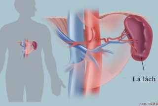 CẮT LÁCH LÀ GÌ? CHUYỆN GÌ CÓ THỂ XẢY RA KHI LÁCH CỦA TÔI ĐÃ BỊ CẮT?