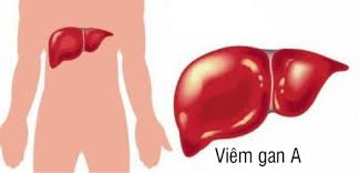 VIÊM GAN A LIỆU CÓ LÂY QUA ĐƯỜNG ĂN UỐNG?