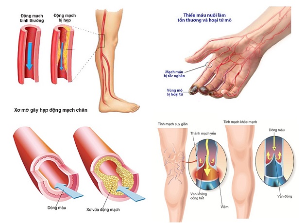 Hệ thống chuẩn đoán mạch máu ngoại biên và hệ thống thần kinh tự chủ