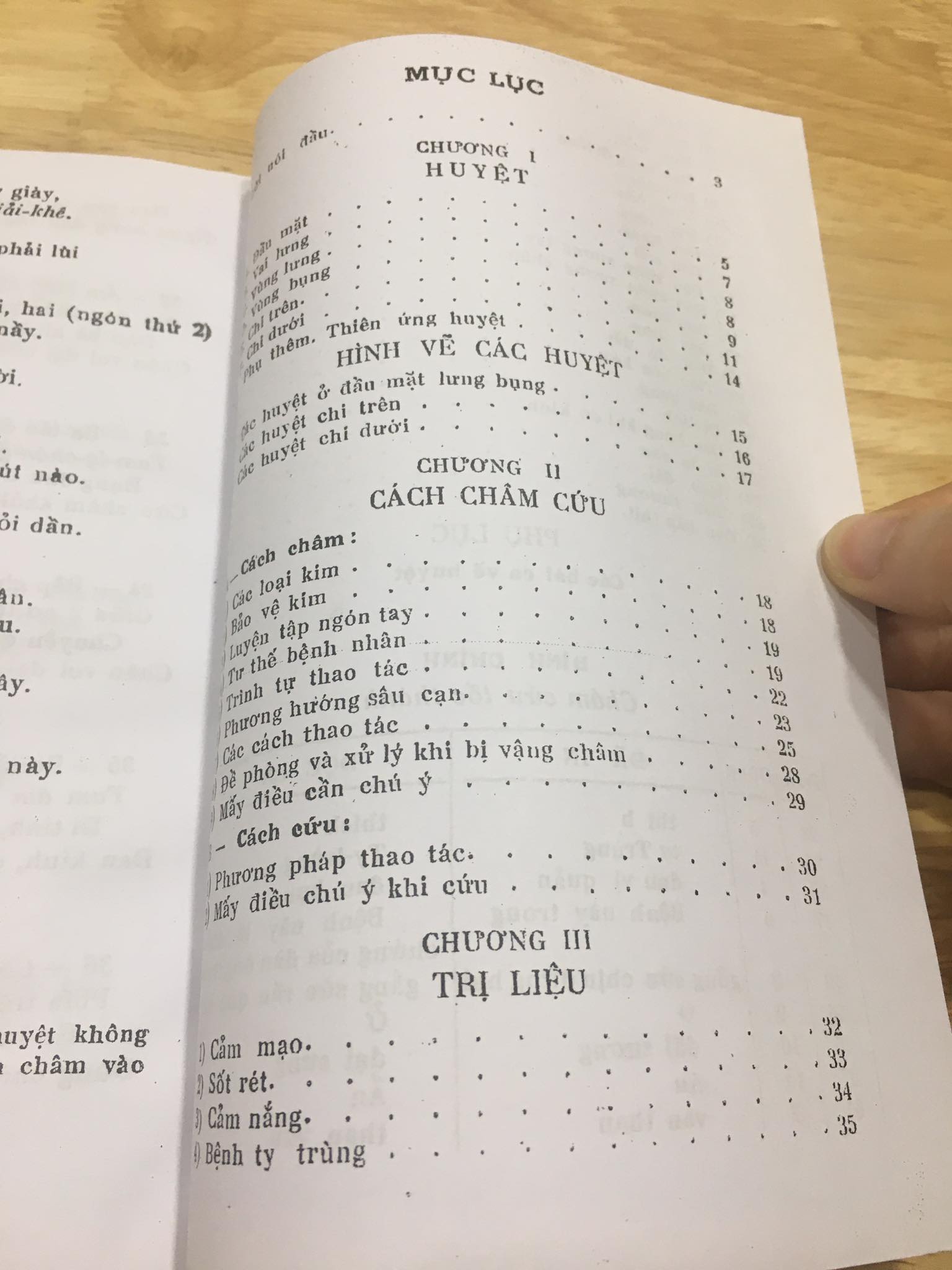 Châm cứu tốc thành