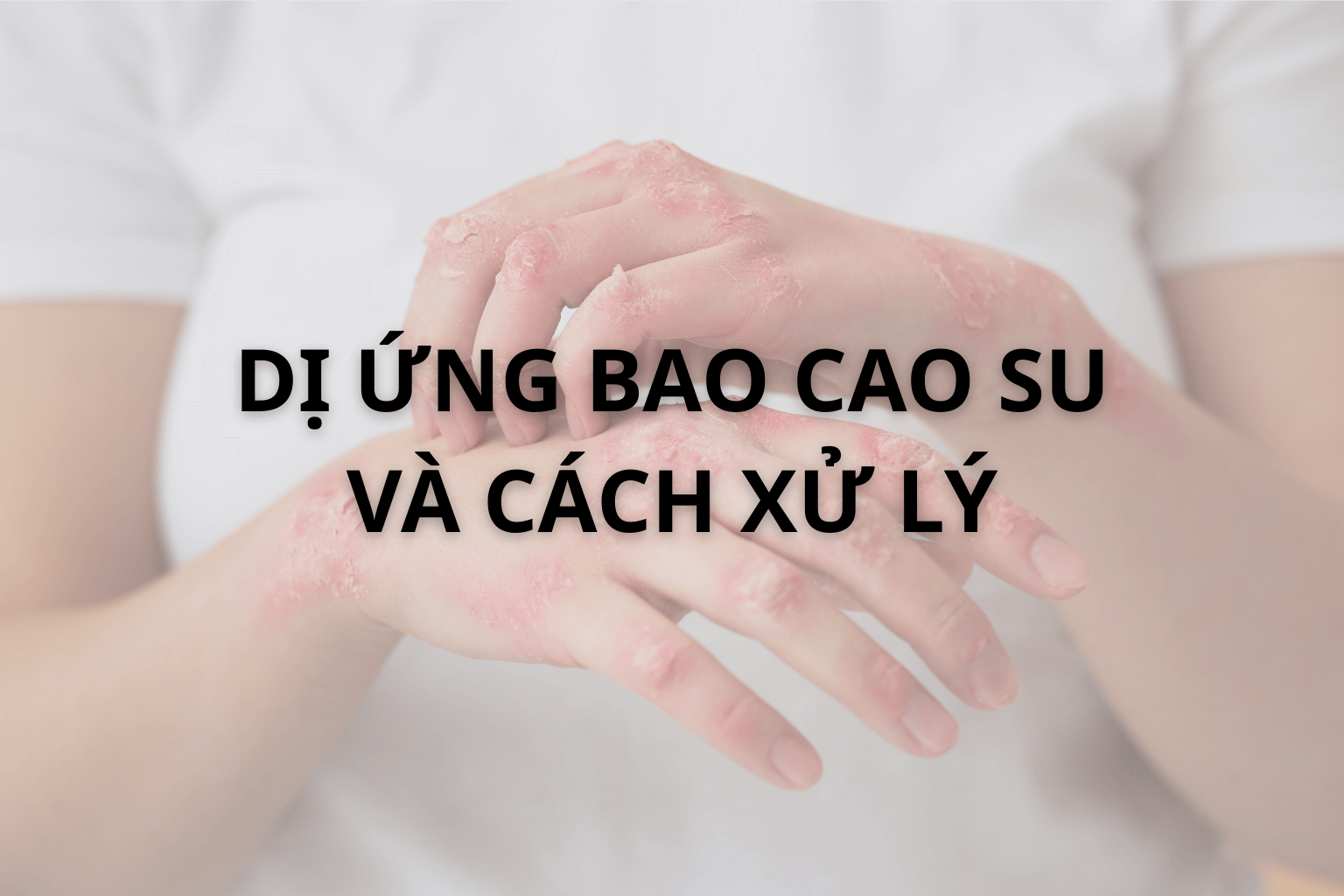 Dị Ứng Bao Cao Su Và Cách Xử Lý