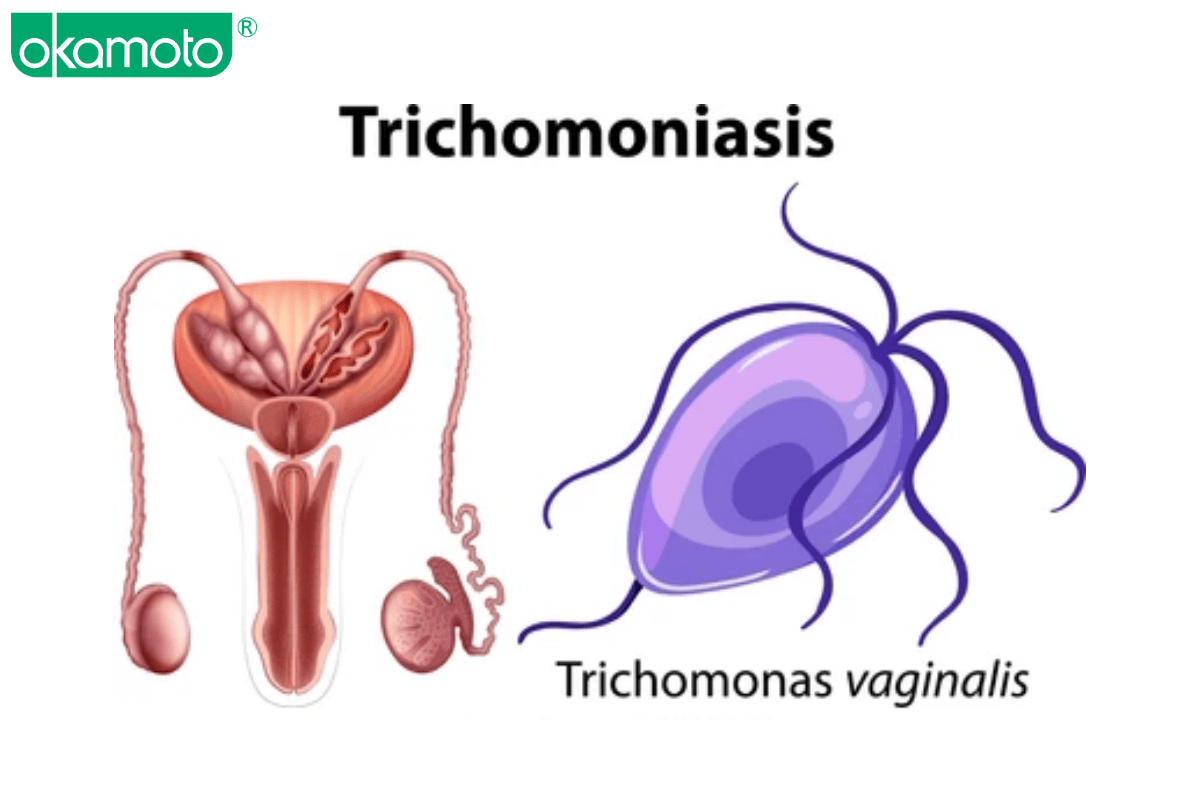 trichomonas nam men va viem am dao do vi khuan o nu nu