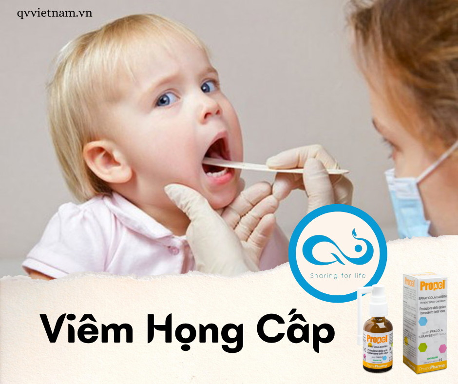 VIÊM HỌNG CẤP LÚC GIAO MÙA, bạn đã biết cần làm gì chưa?