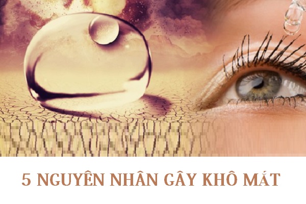 5 NGUYÊN NHÂN THƯỜNG GẶP GÂY KHÔ MẮT?