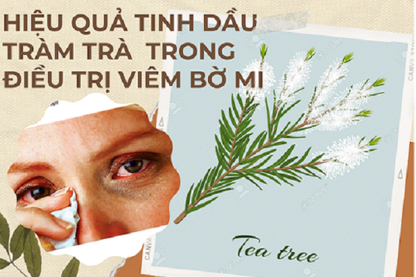 HIỆU QUẢ TINH DẦU TRÀM TRÀ TRONG ĐIỀU TRỊ VIÊM BỜ MI 