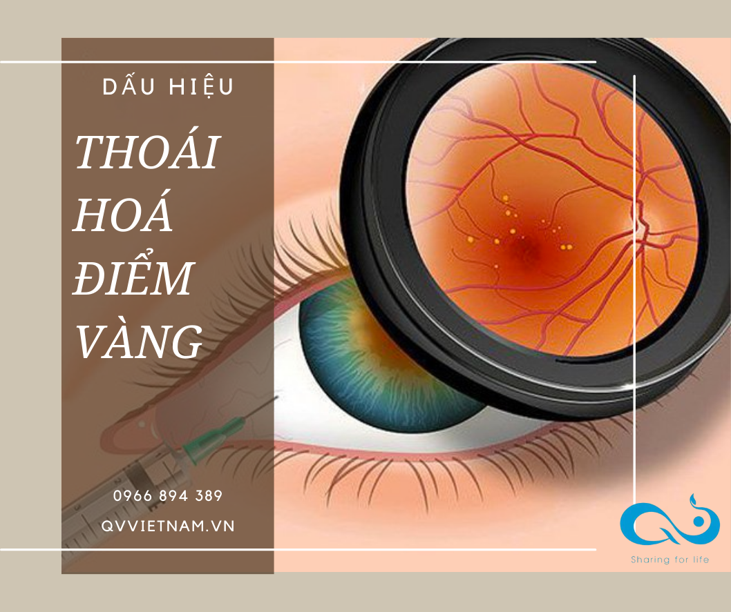 THOÁI HÓA ĐIỂM VÀNG - Các dấu hiệu cảnh báo và ngăn ngừa