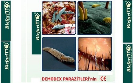 KINH HOÀNG VỚI CHỨNG VIÊM DA DO DEMODEX