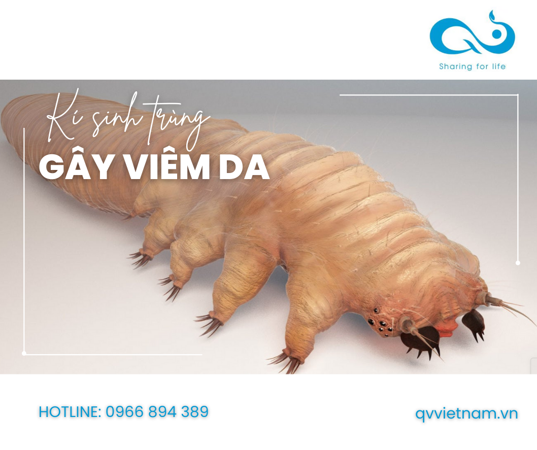 DEMODEX và BỆNH LÝ VIÊM DA TÁI LẠI NHIỀU LẦN. Bạn đã xử lý đúng cách chưa?