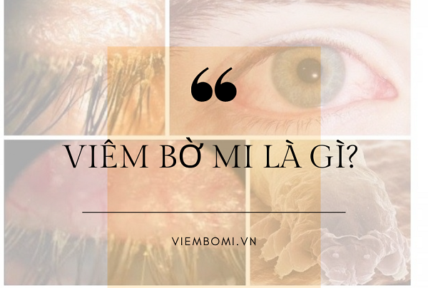 VIÊM BỜ MI LÀ GÌ ?