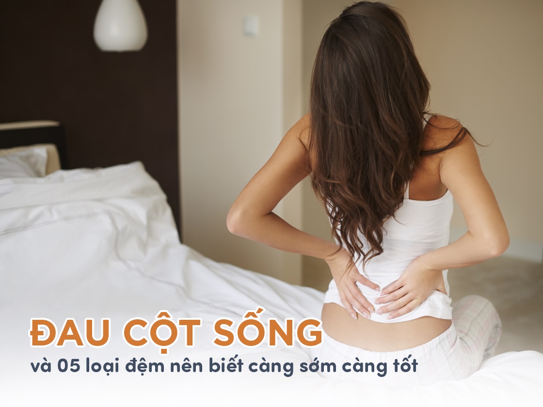 5 loại nệm cho người đau cột sống hiệu quả nhất hiện nay