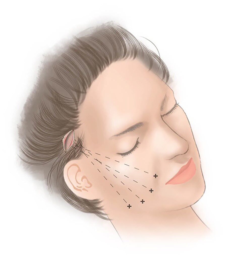 Bật mí bí quyết giúp da bạn căng mượt săn chắc