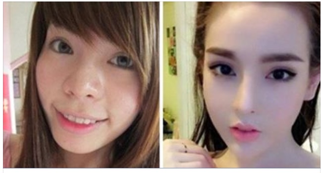 Ngỡ ngàng với ảnh trước và sau phẫu thuật của hot girl Vân Tokyo 