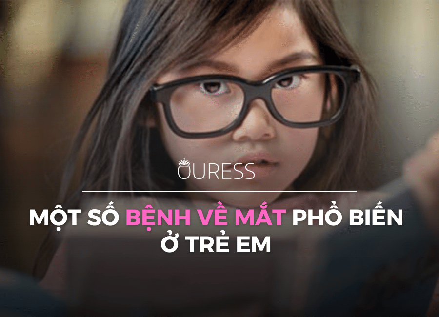 Một số bệnh về mắt phổ biến ở trẻ em