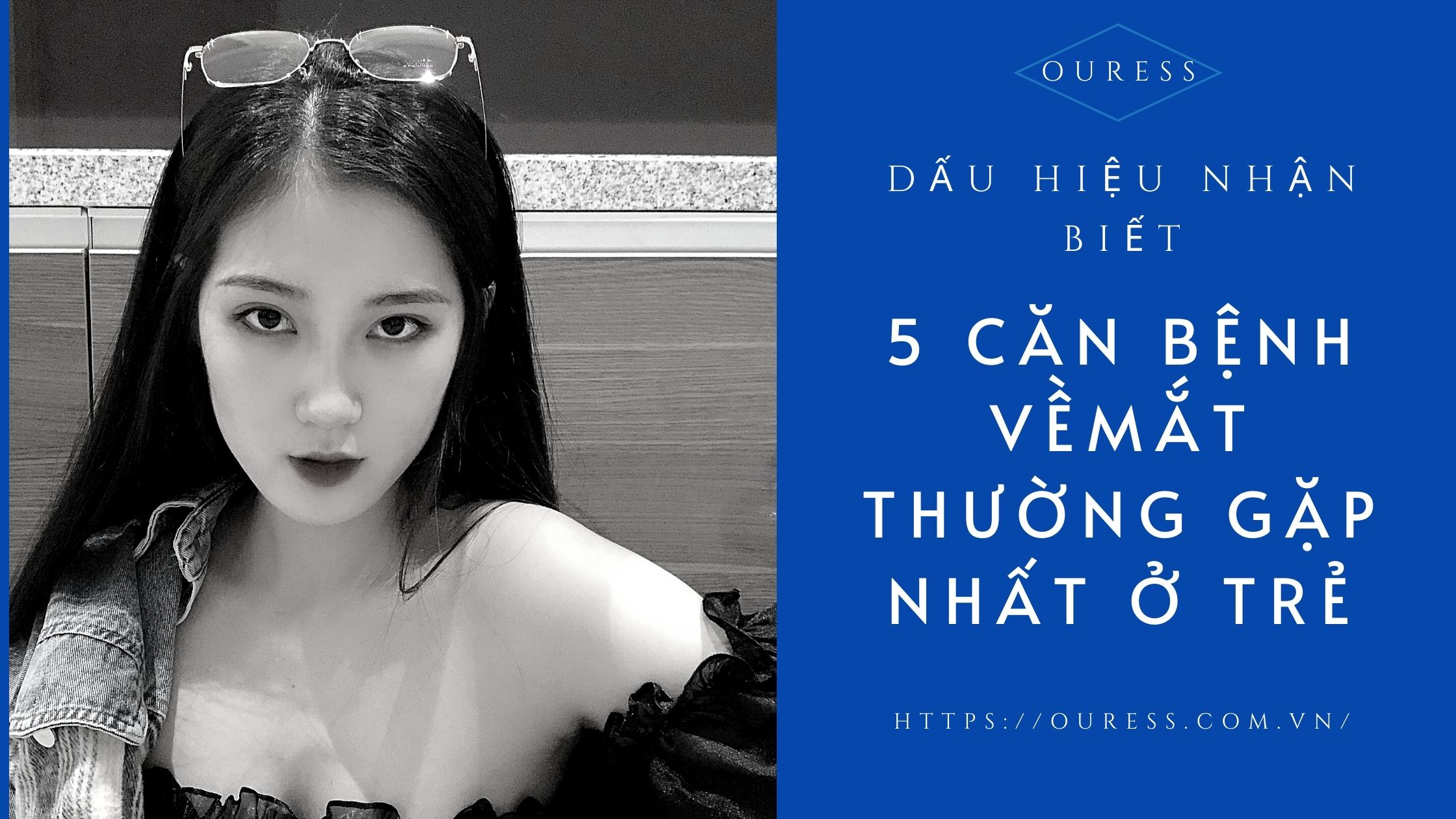 DẤU HIỆU NHẬN BIẾT 5 CĂN BỆNH VỀ MẮT THƯỜNG GẶP NHẤT Ở TRẺ