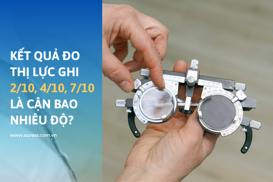 Kết quả đo thị lực ghi 2/10, 4/10, 7/10 là cận bao nhiêu độ?