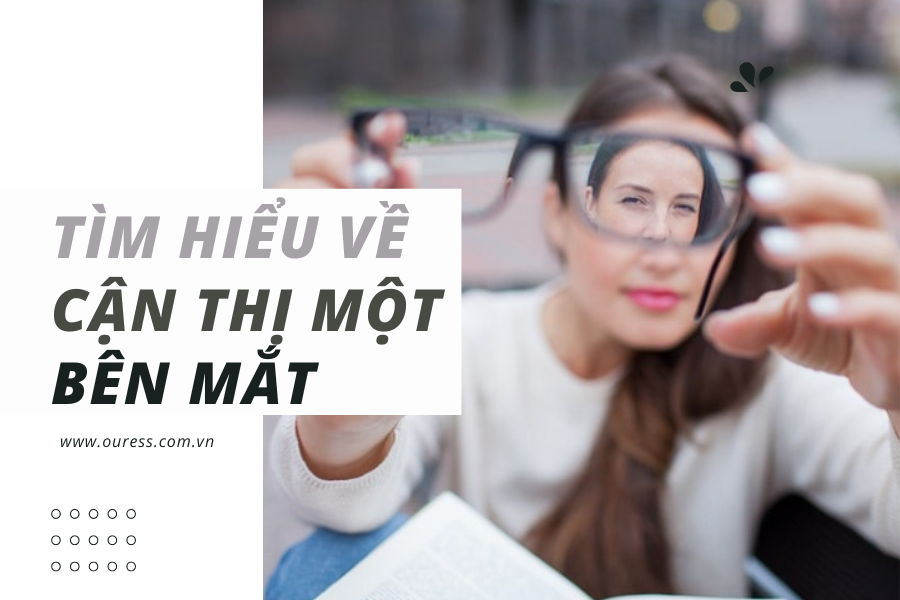Cận thị một bên mắt là gì? 