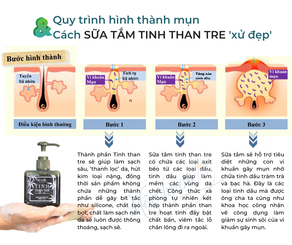 Thực hư chuyện trị mụn lưng của Sữa tắm Tinh than tre Mộc Hương